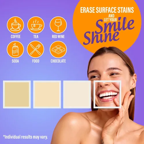 Vista 5 de GuruNanda Kit Premium de Blanqueamiento Dental con Luz LED Conectada y Lápiz Blanqueador, Funciona con iPhone y Android, Ayuda a Eliminar Manchas