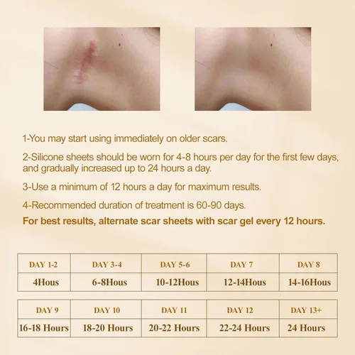 Vista 9 de Hojas de silicona para cicatrices, cinta de silicona para cicatrices, hojas de silicona para cicatrices (rollo de 1.6 x 59 pulgadas - 4.9 ft) sin