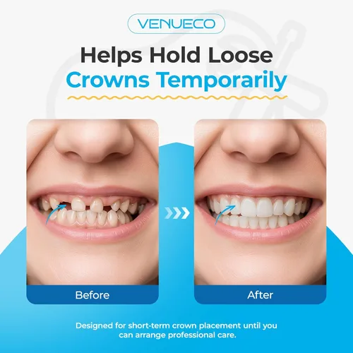 Vista 6 de Kit de reparación de llenado de dientes - Kit de cuidado dental de cemento de óxido de zinc Eugenol Pegamento para llenado de coronas y puentes