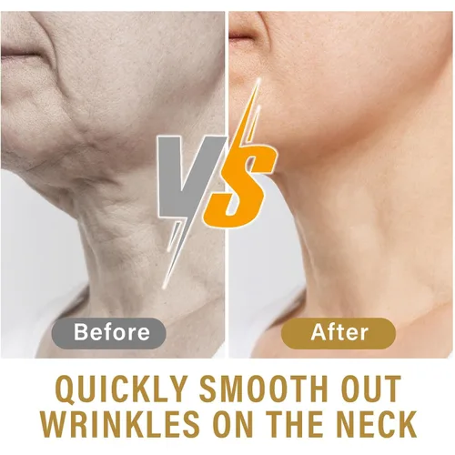Vista 4 de Neck Lift Tape - 20 Pcs Invisible Strips for Sagging Skin and Double Chin - Instant Lifting Water-Resistant Breathable Patches for Face Jawline