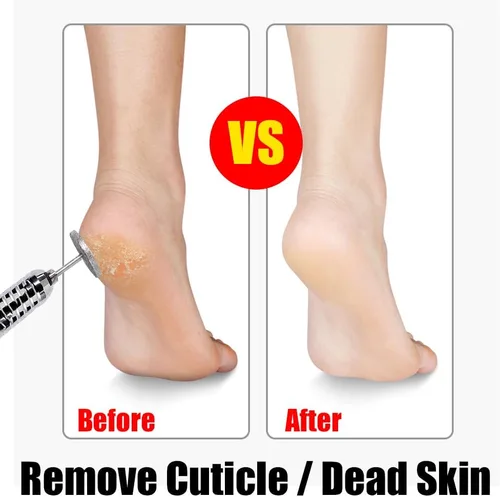 Vista 7 de Disco de lijado para uñas, lima eléctrica de pie, brocas para uñas de piel muerta, broca de cutícula para taladro de uñas, removedor de callos