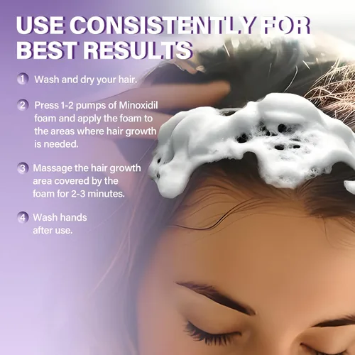 Vista 5 de Espuma de Minoxidil 5% para el Crecimiento del Cabello de Mujeres, Adecuada para Adelgazamiento del Cabello, Línea de Cabello Retraída y Pérdida