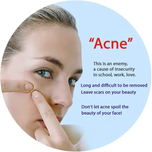 Vista 2 de (0BQY0733) Mascarilla Hidratante Rejuvenecimiento Eliminación del Acné