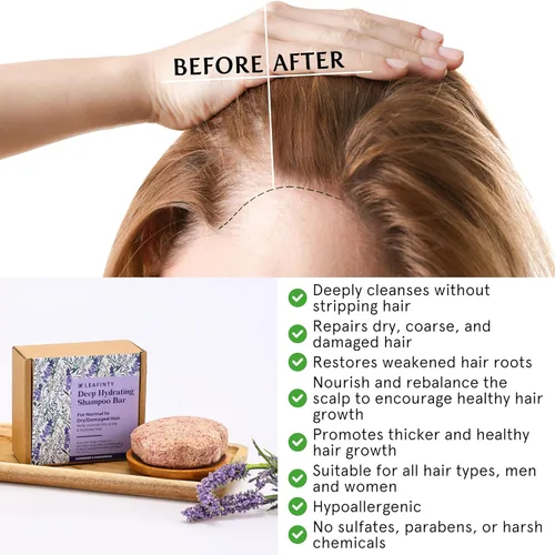 Vista 4 de Leafinty Barras de champú para el crecimiento del cabello, barra de champú sólida para cabello seco y dañado, barra de champú con soporte