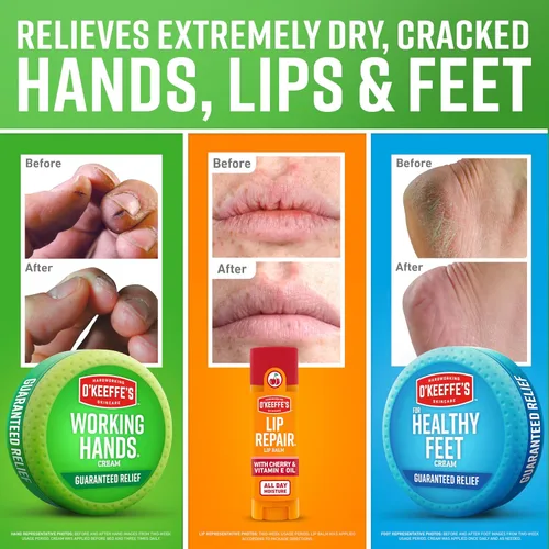 Vista 3 de Caja de regalo de O'Keeffe's que incluye barra de reparación de labios con aceite de cereza y vitamina E, tarro de manos trabajadoras y tarro