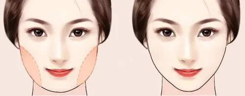 Vista 7 de Reductor de doble barbilla máscara de elevación de línea en V reutilizable correa de adelgazamiento facial cinturón de elevación facial correa