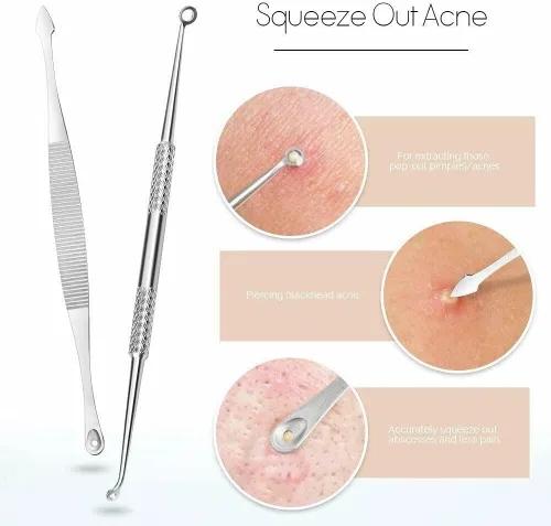 Vista 4 de Kit de herramientas para eliminar puntos negros, kit de 9 piezas, herramienta profesional de extracción de espinillas de acero inoxidable