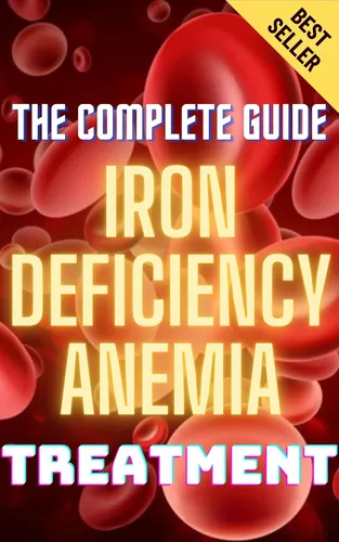 Iron Deficiency Anemia Treatment & Management The Complete Guide To Anemia Symptoms, Causes, Diagnosis & Remedies