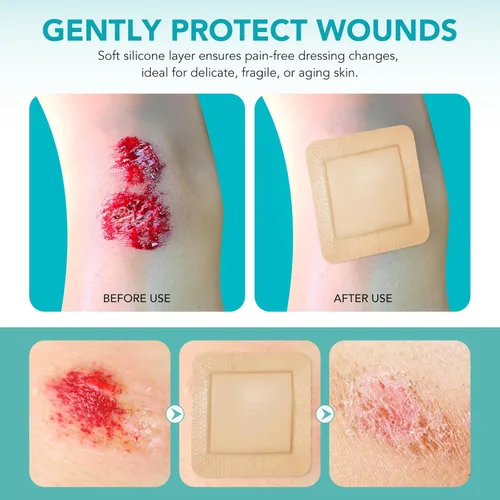 Vista 4 de Vendaje estéril de espuma de silicona para heridas con borde adhesivo de silicona suave impermeable (10 paquetes), almohadillas transpirables ultra