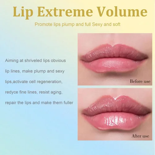 Vista 2 de Juego de regordete de labios – Lip Plumper Extreme – Brillo de labios voluminoso – Reforzador de labios – Hidratante labial para labios secos